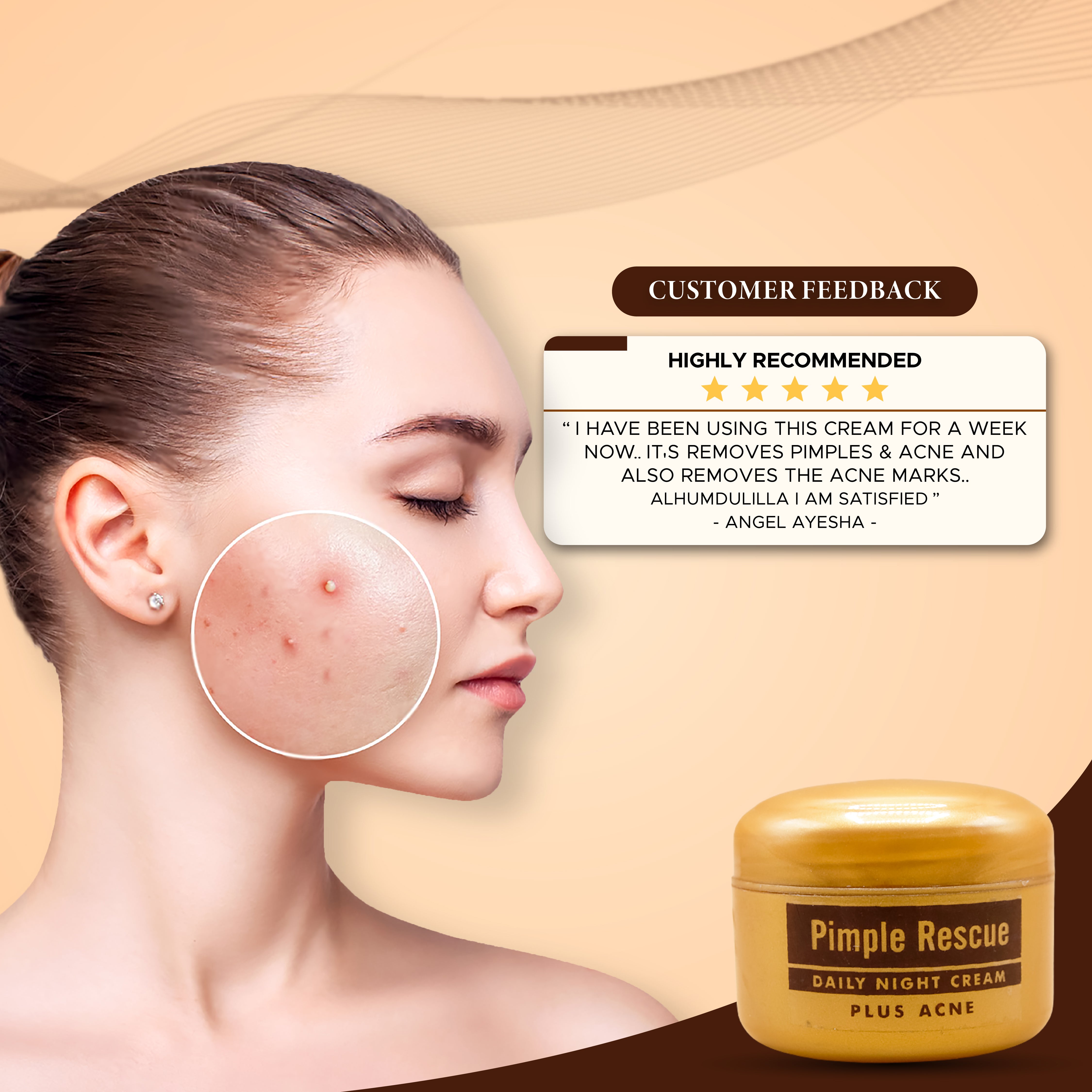 Pimple Rescue Night Cream for Oily & Acne-Prone Skin
